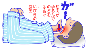 いびき